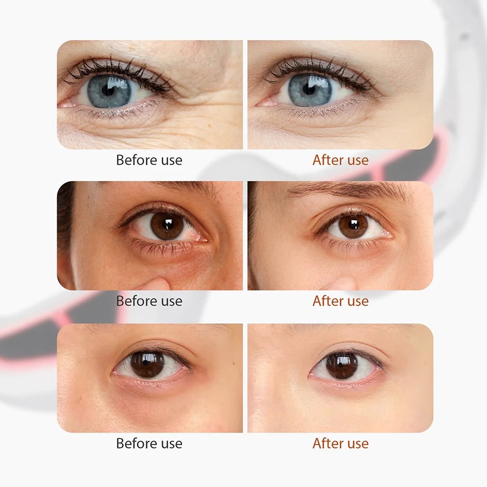 AuraRelieve™ Red Light Under-Eye Massager Glasses - Glow Labs USA - 14